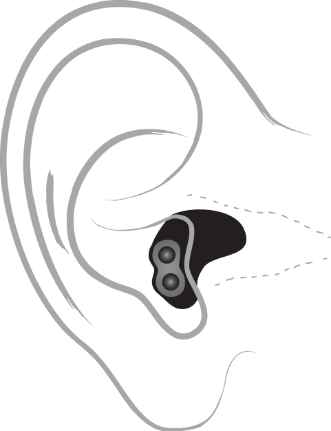 Completely in the canal hearing aid diagram