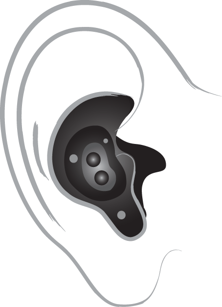 In the ear hearing aid diagram